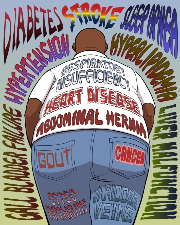 Obesity-Related Diseases